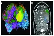 مطالعه پیشرفته MRI مدارهای مغزی پشت عملکردهای شناختی کلیدی را ترسیم می‌کند